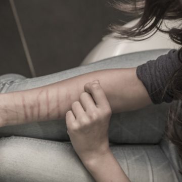 Ragazzi che si tagliano. Il rumoroso silenzio dell’autolesionismo